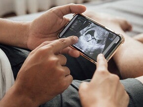 Echo baby op telefoon Echo baby op telefoon