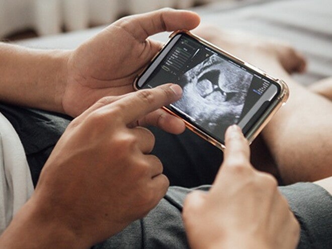 Echo baby op telefoon Echo baby op telefoon