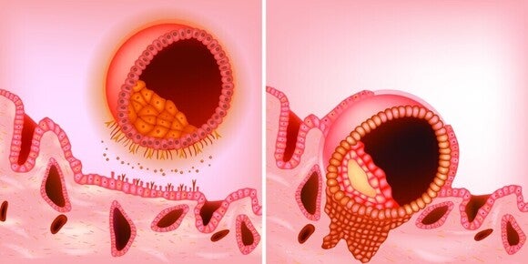 Schematische weergave van de innesteling van een embryo in de baarmoederwand